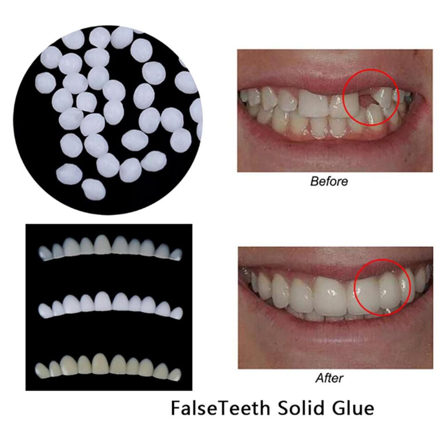 Click to open expanded view KYKHT Moldable Teeth Veneers wth Adhesive Fitting Beads Temporary False Teeth Health & Beauty Oral Care Whitening Soft Materiall