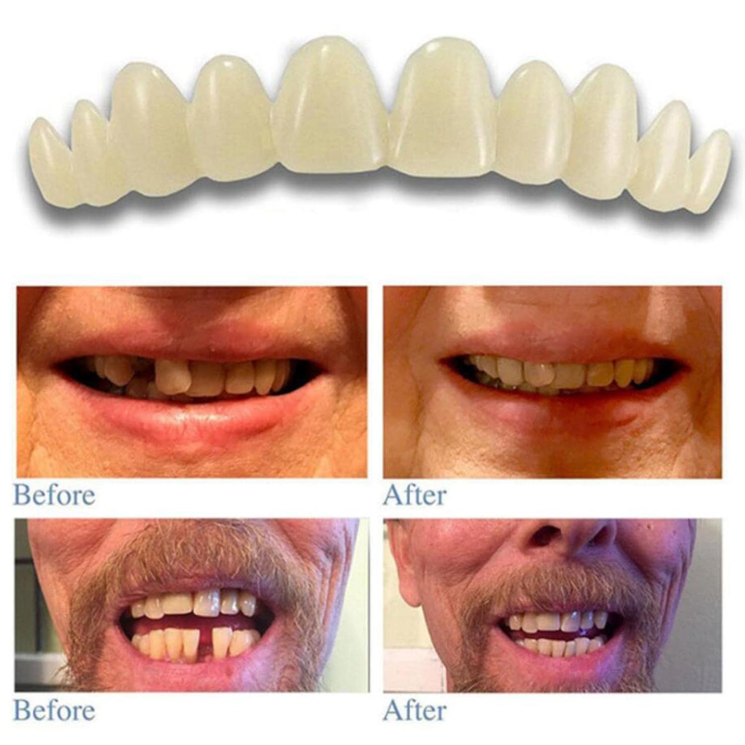 Click to open expanded view KYKHT Moldable Teeth Veneers wth Adhesive Fitting Beads Temporary False Teeth Health & Beauty Oral Care Whitening Soft Materiall