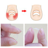 120pcs Pedicure Ingrown Toenail Straightening Clip Sticker Brace 4mm