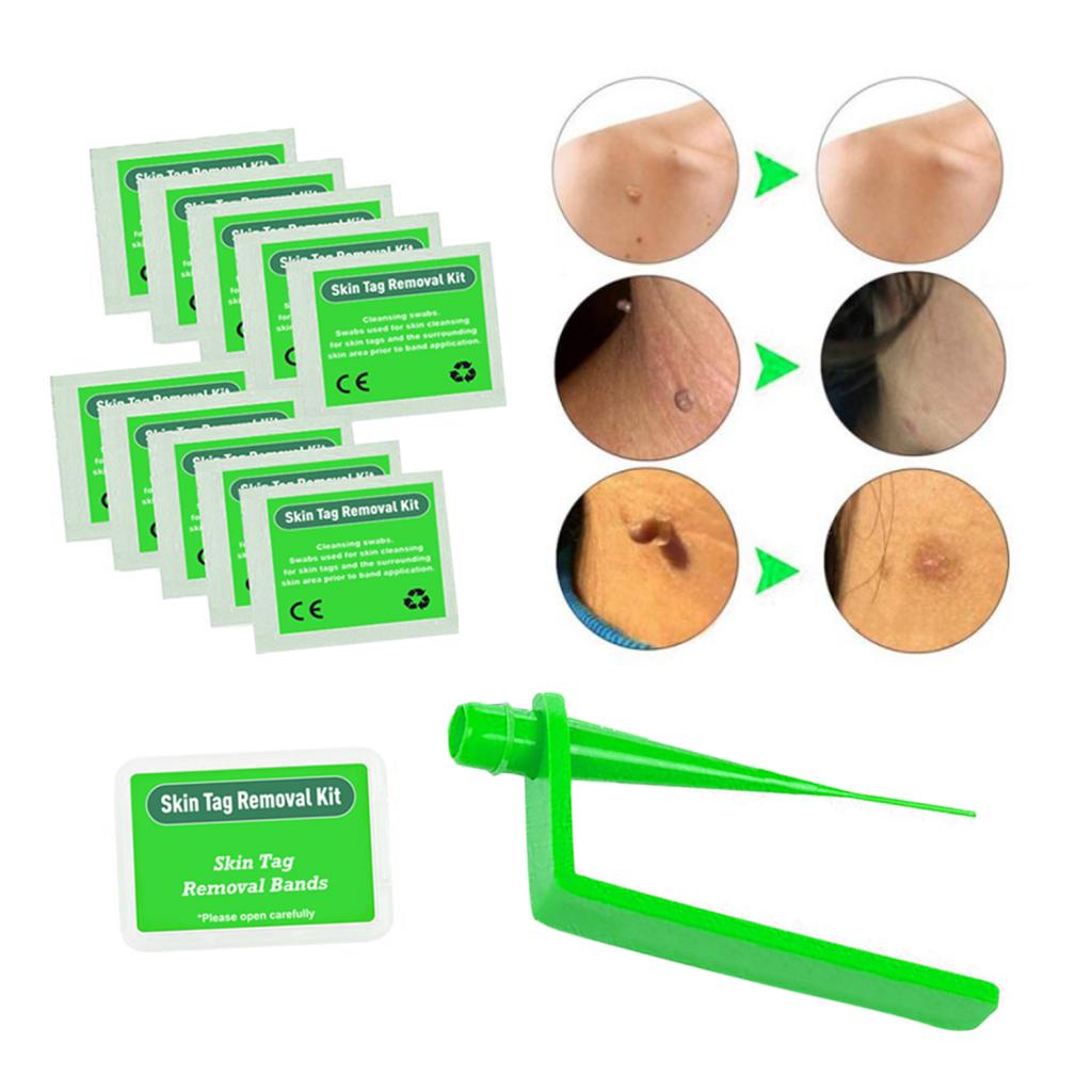 Skin Tag Removal Device Kit Effective Skin Tags Removal Green