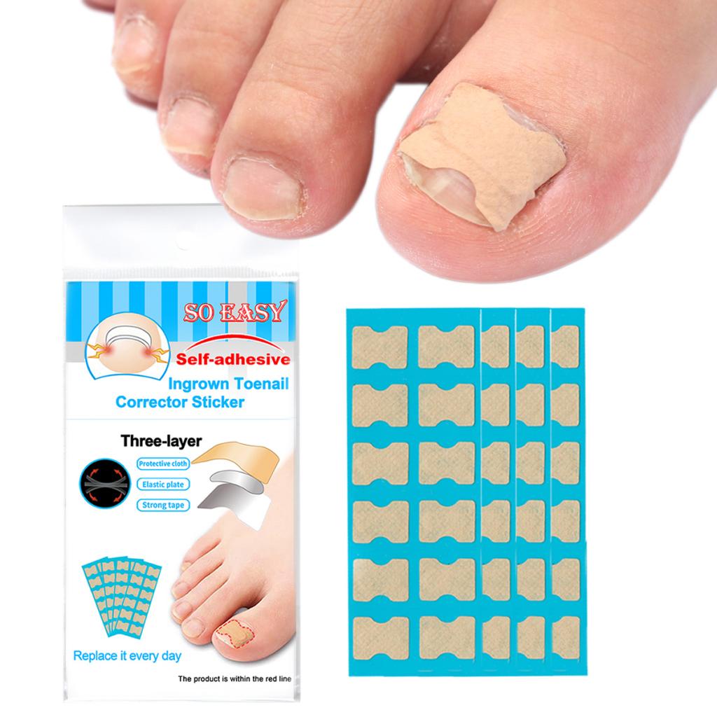 1 Set Ingrown Toenail Corrector Stickers Toe Nail Treatment Patch 120 Sheets