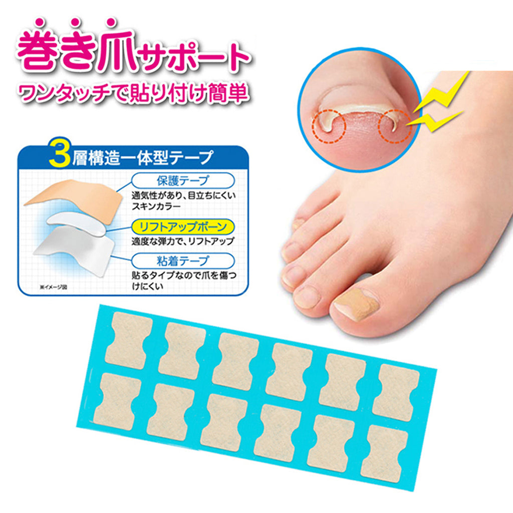 1 Set Ingrown Toenail Corrector Stickers Toe Nail Treatment Patch 120 Sheets