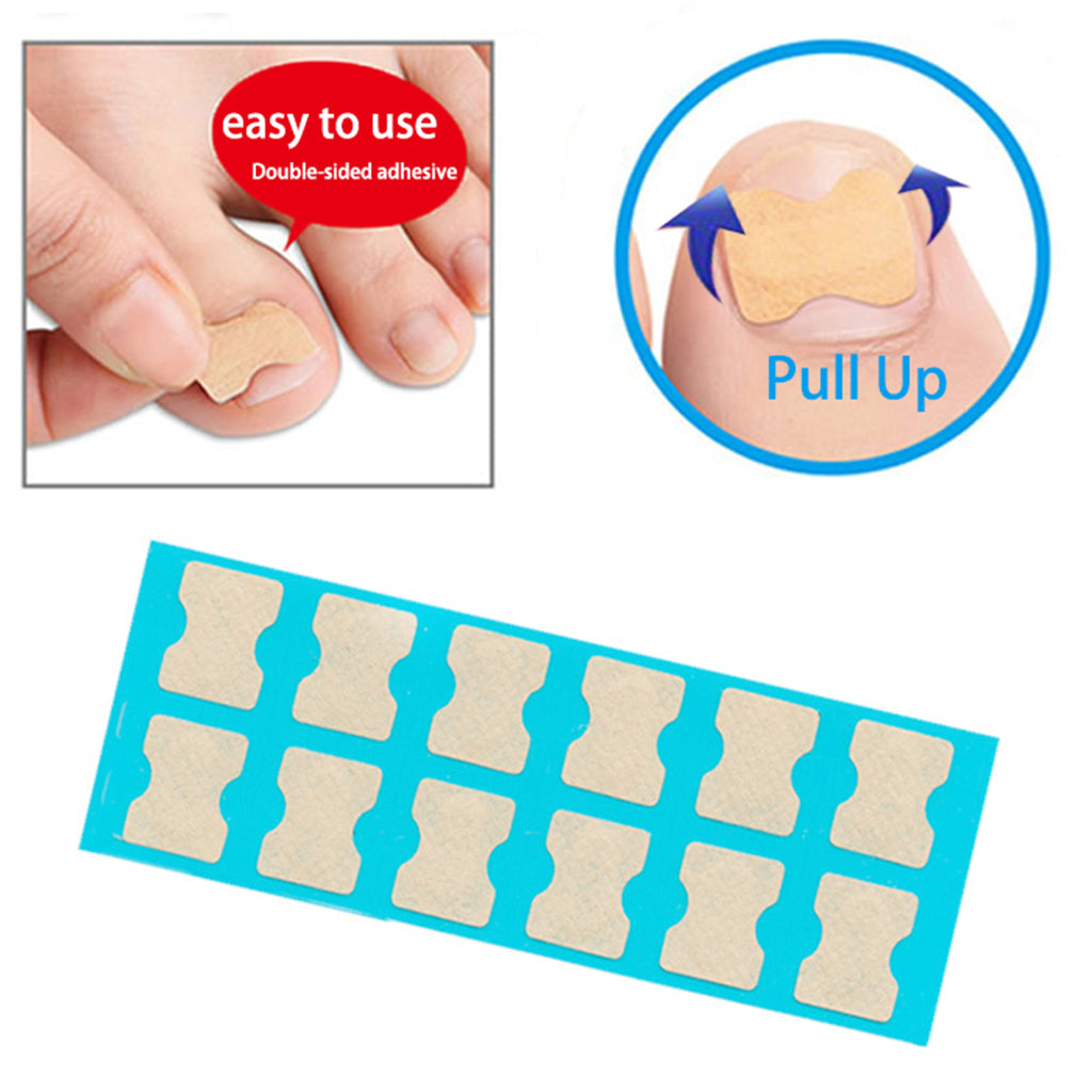 1 Set Ingrown Toenail Corrector Stickers Toe Nail Treatment Patch 120 Sheets