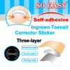 1 Set Ingrown Toenail Corrector Stickers Toe Nail Treatment Patch 120 Sheets