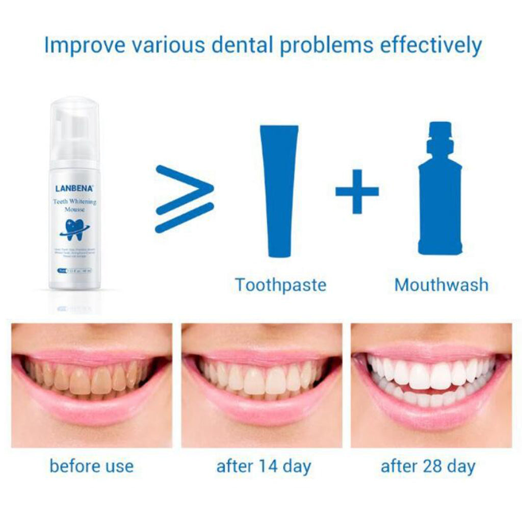 Daily Teeth Whitening Whiten Foam for Home Use Maintain a Brighter Smile