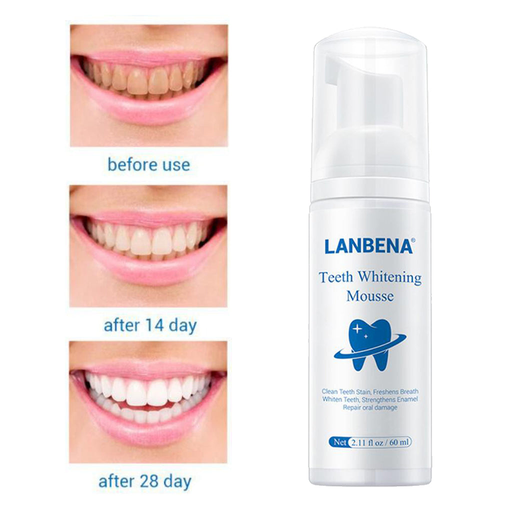 Daily Teeth Whitening Whiten Foam for Home Use Maintain a Brighter Smile