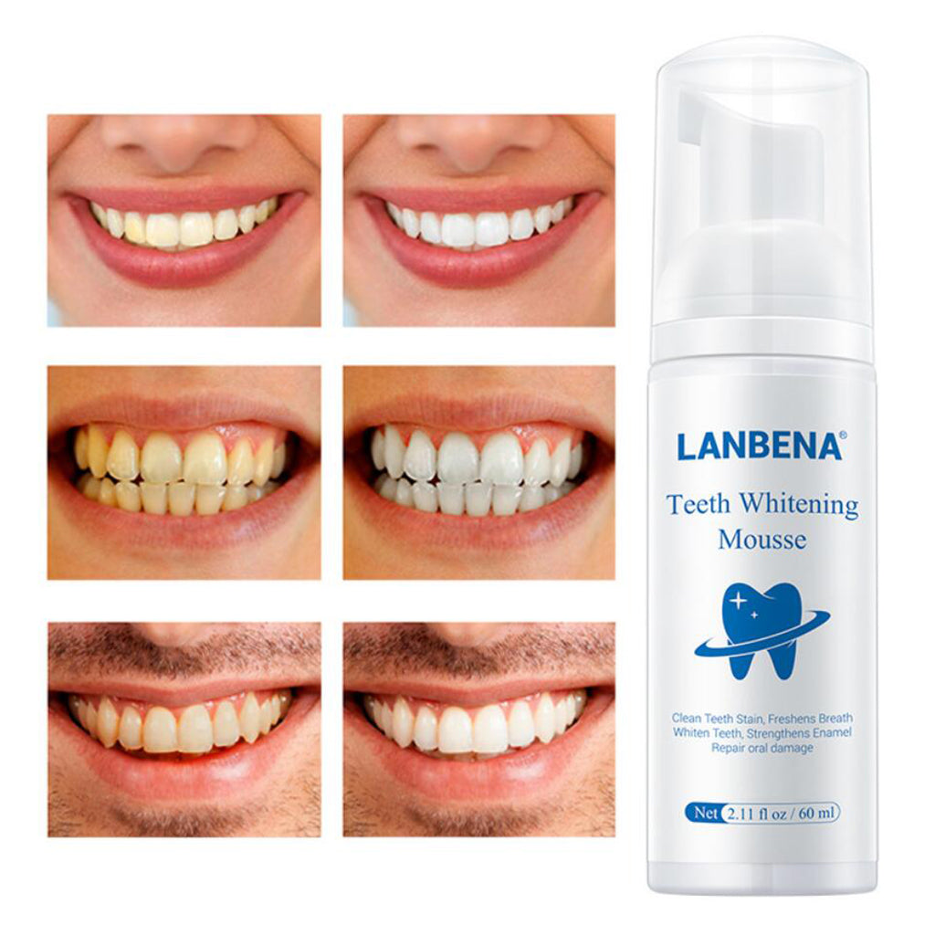 Daily Teeth Whitening Whiten Foam for Home Use Maintain a Brighter Smile