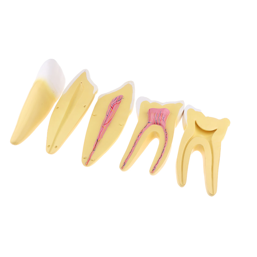12x Enlarged Anatomical Human Teeth Tooth Model, Set of 3 Different Models