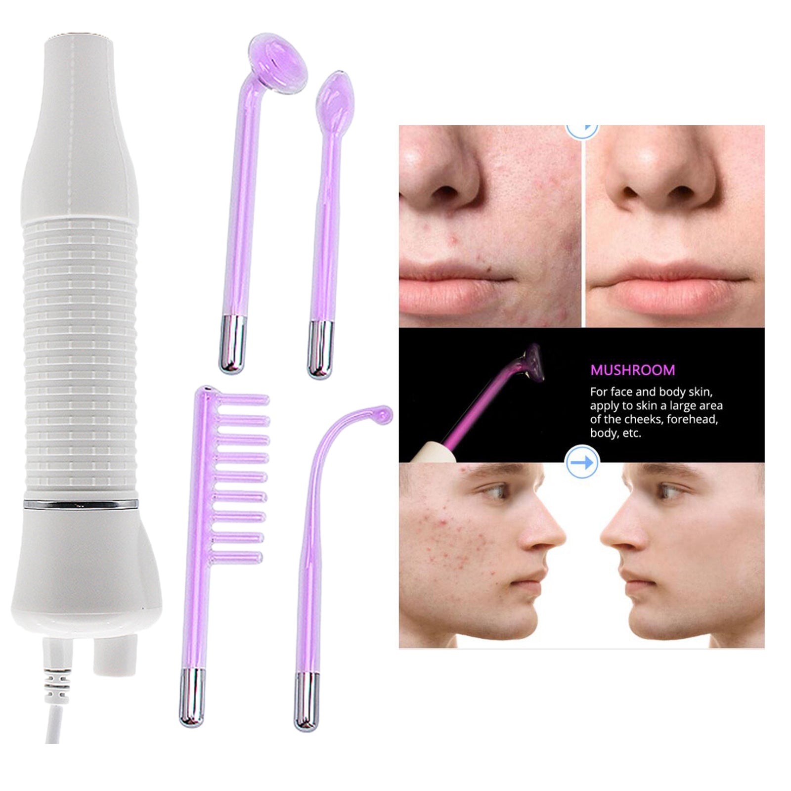 Portable High Frequency Spot Remover w/4 Wand Electronicy-EU Purple Light