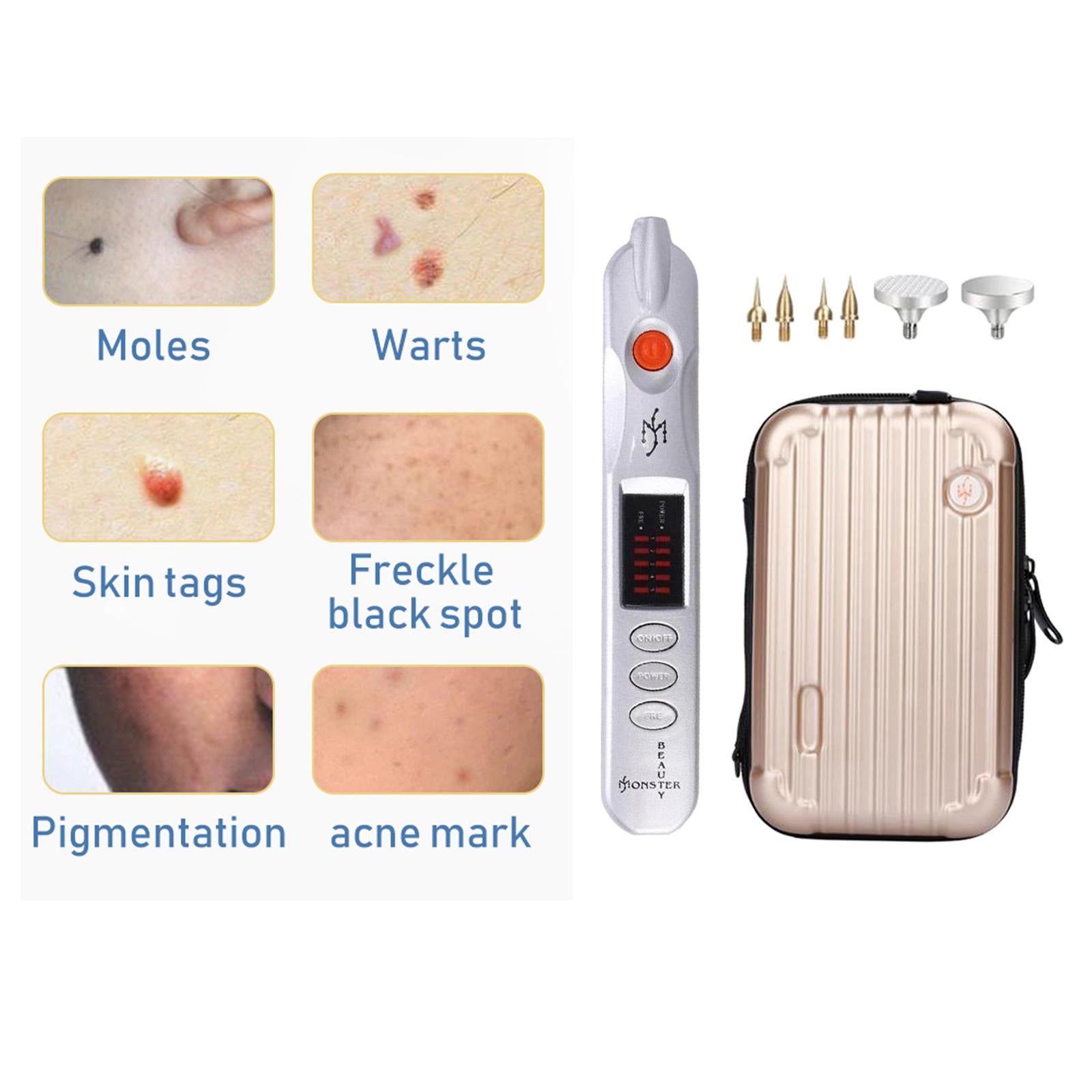 Laser Plasma Pen Mole Removal Dark Spot Remover Skin Wart Tag EU Silver