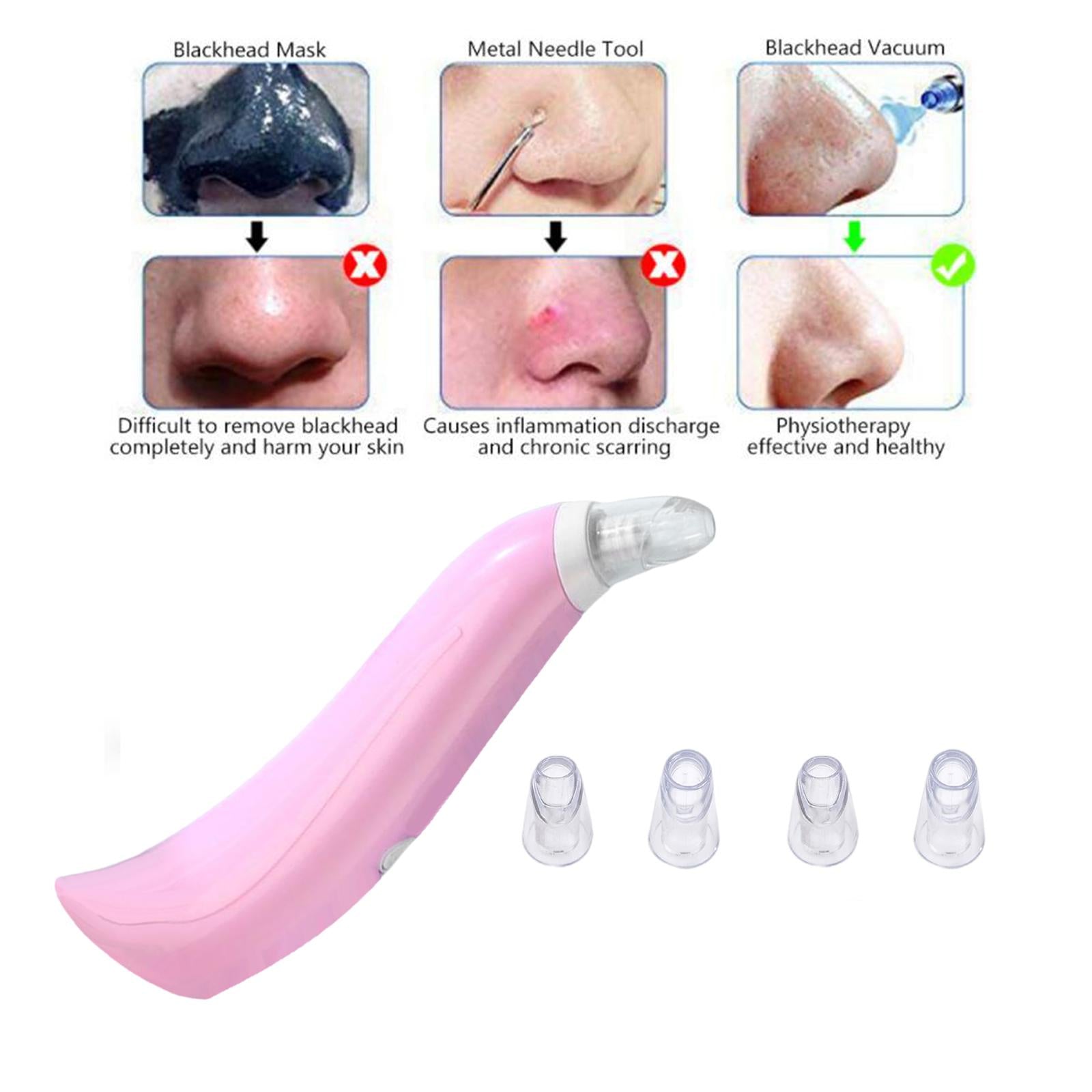 Face Skin Care Blackhead Remover Acne Vacuum Suction Spot Cleaner Pink