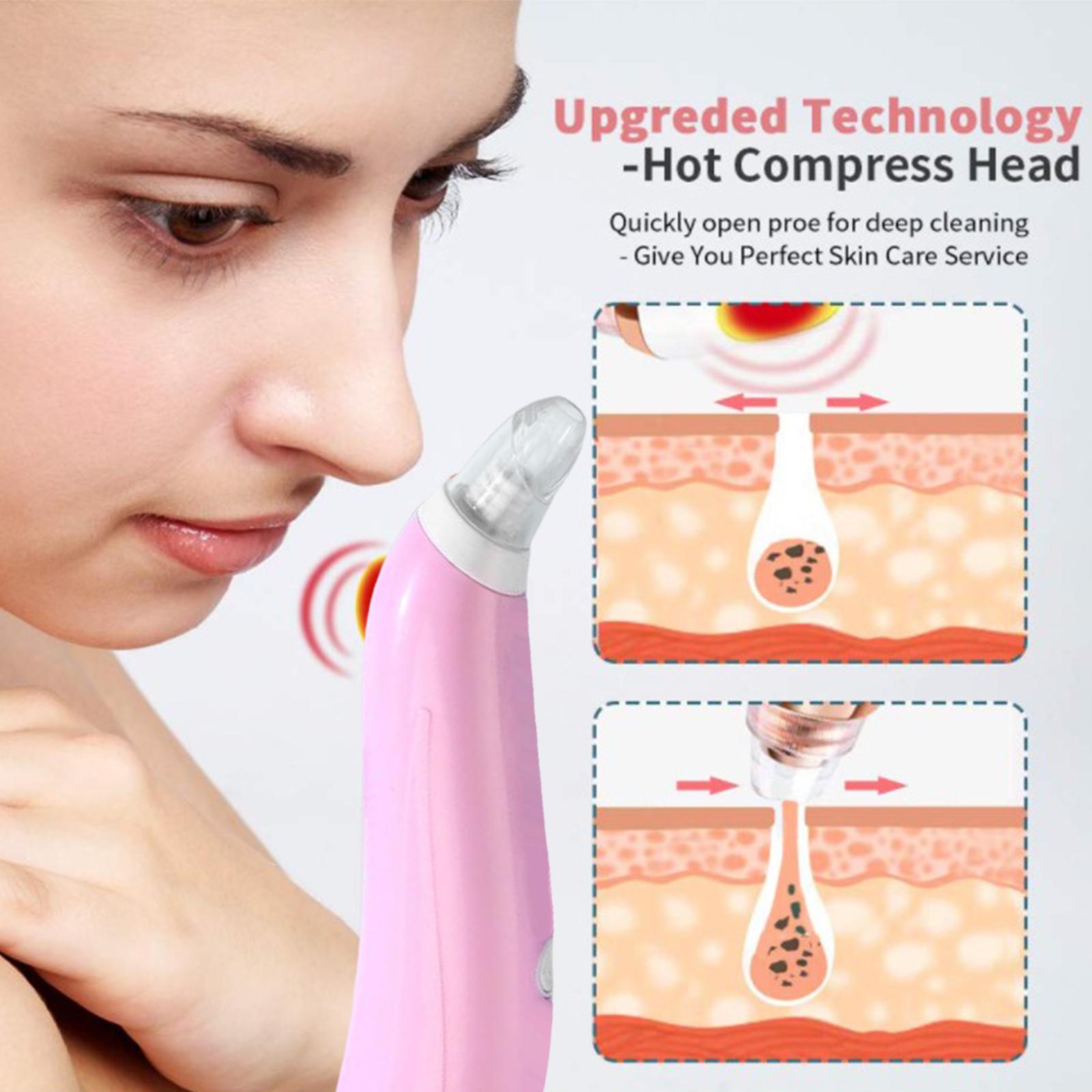 Face Skin Care Blackhead Remover Acne Vacuum Suction Spot Cleaner Pink