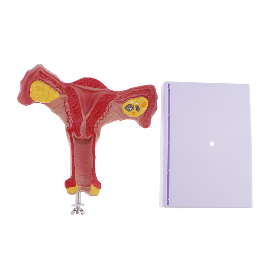 1:1 Human Female Genital System Bilateral Ovarian Uterus Ovary Study Model